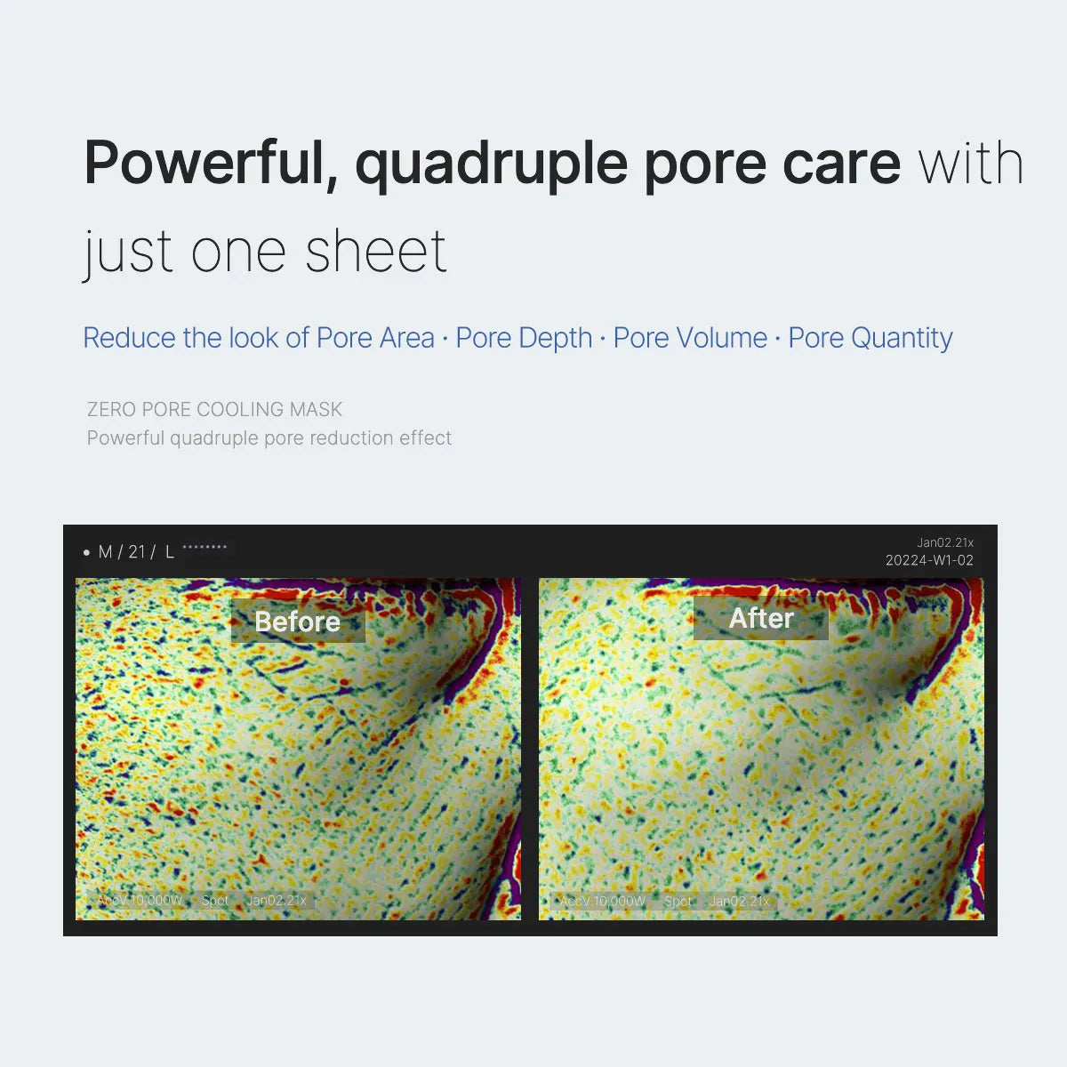 Medicube Zero Pore Kühlmaske